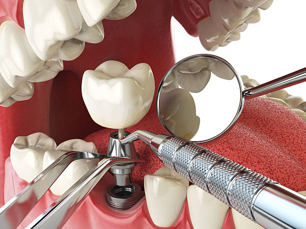 Best Emergency Dental Care for Trauma or Injury in Viola, NY
