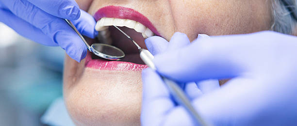 Best Emergency Broken Tooth Repair in Viola, NY